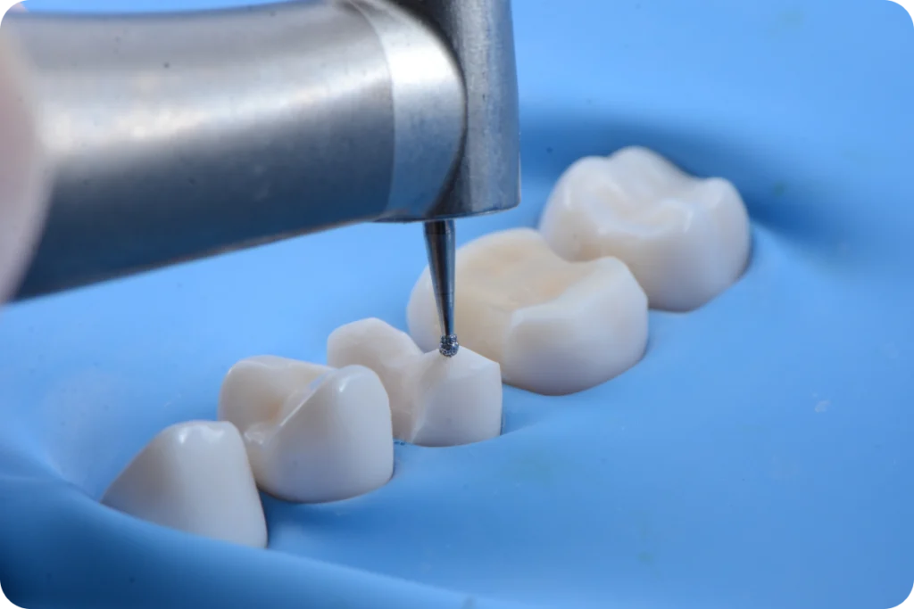 Consultation pour soins conservateurs