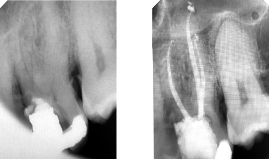 Diagnostic d’une douleur dentaire à Saint-Cyr-sur-Mer